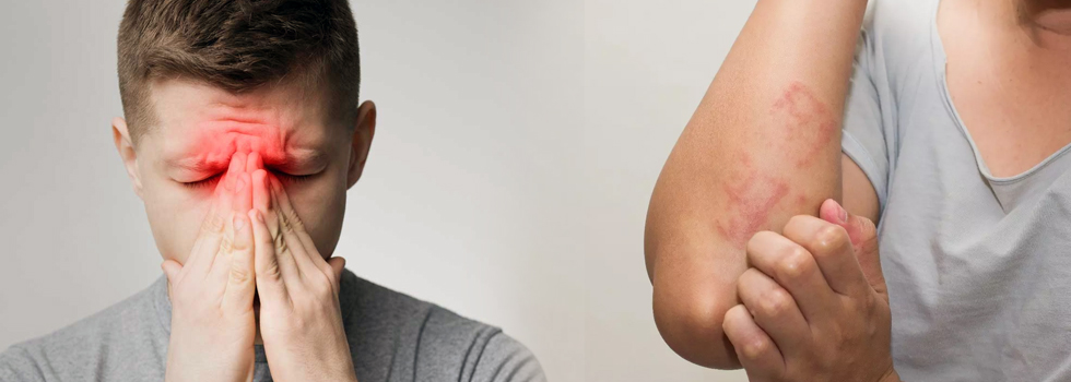 Chronic Allergy Treatments
